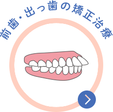 阿波座・本町のタニ矯正歯科で行う前歯のゆがみ・出っ歯の矯正治療