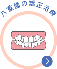 阿波座・本町のタニ矯正歯科で行う八重歯の矯正治療